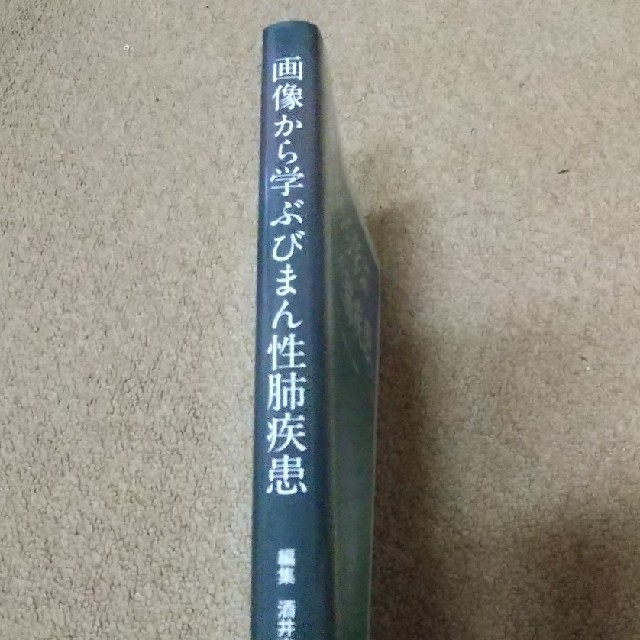 画像から学ぶびまん性肺疾患 エンタメ/ホビーの本(健康/医学)の商品写真