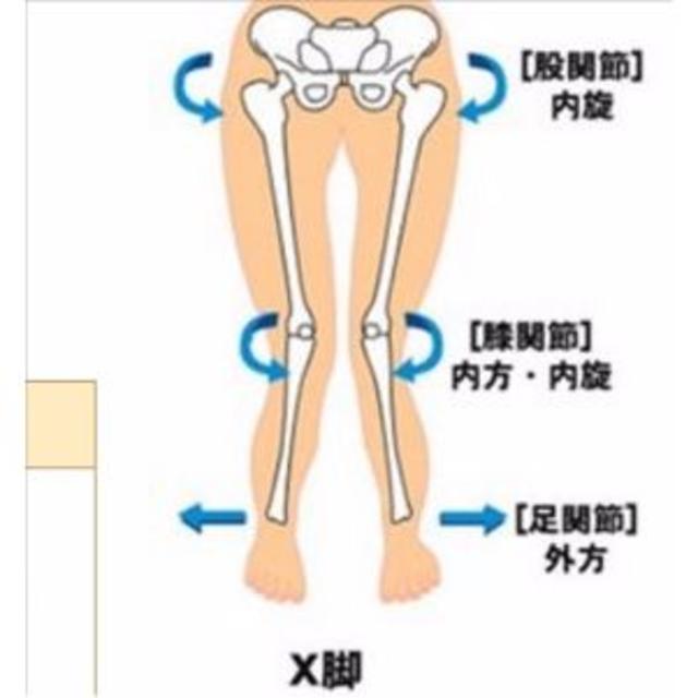 X脚 O脚 かかと　インソール　2枚  コスメ/美容のボディケア(フットケア)の商品写真