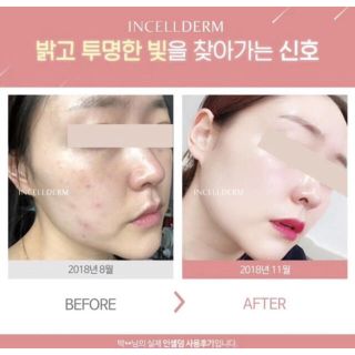 INCELLDERM インセルダム Cream クリーム　新品未開封・単品・お得