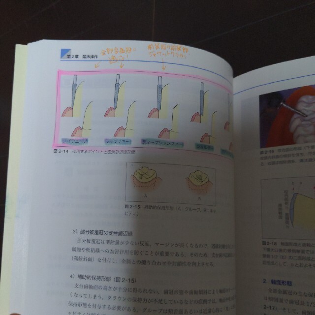 クラウンブリッジ補綴学 第５版 エンタメ/ホビーの本(健康/医学)の商品写真