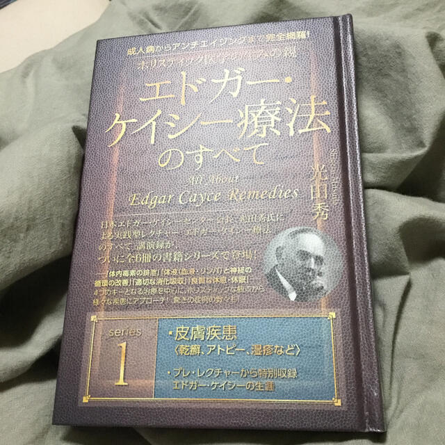 エドガー ケイシー 療法