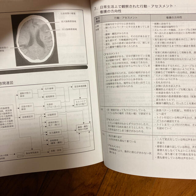 脳血管障害による高次脳機能障害ナ－シングガイド エンタメ/ホビーの本(健康/医学)の商品写真