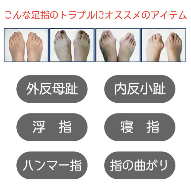 小指保護パッド 内反小趾サポーター シリコン 小指 矯正 保護 4個セットの通販 By Okome Shop ラクマ 小指保護パッド 内反小趾サポーター シリコン 小指 矯正 保護 4個セットの通販 By Okome Shop ラクマ