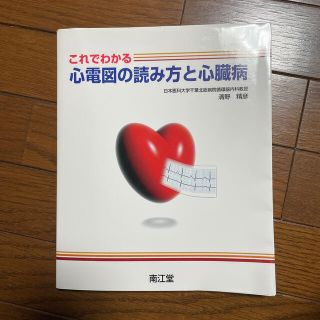 これでわかる心電図の読み方と心臓病(健康/医学)