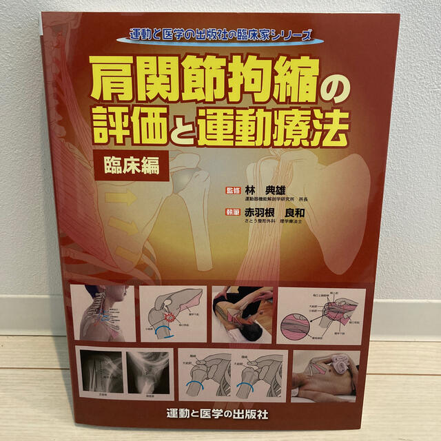 肩関節拘縮の評価と運動療法　臨床編