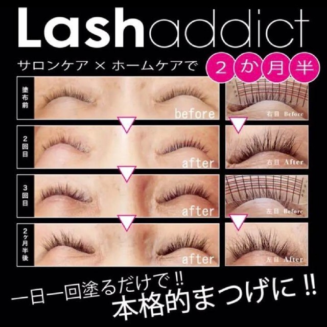 まつけ美容液 ラッシュアディクト Lashaddict まつ毛美容液 コスメ/美容のスキンケア/基礎化粧品(まつ毛美容液)の商品写真