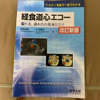 カラー写真で一目でわかる経食道心エコー 撮り方，診かたの基本とコツ 改訂新版(健康/医学)