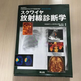 スクワイヤ放射線診断学(健康/医学)