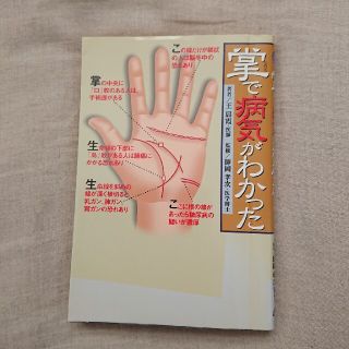 掌で病気がわかった(健康/医学)