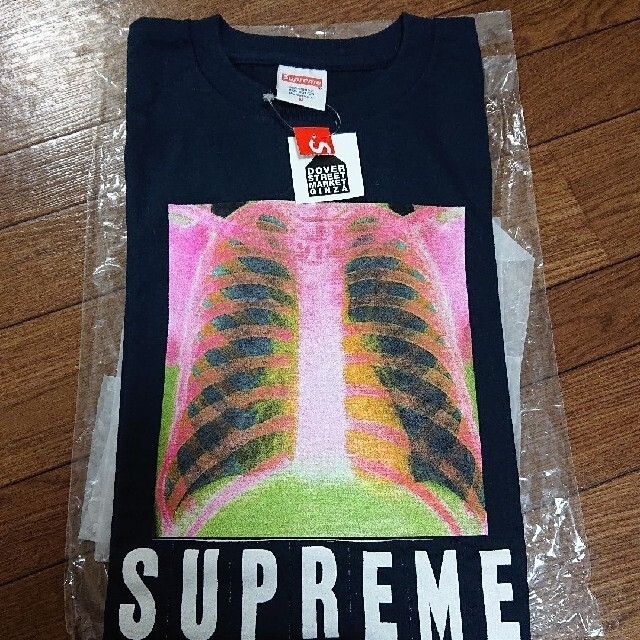 カラーネイビーサイズMSupreme X-ray (レントゲン) TEE