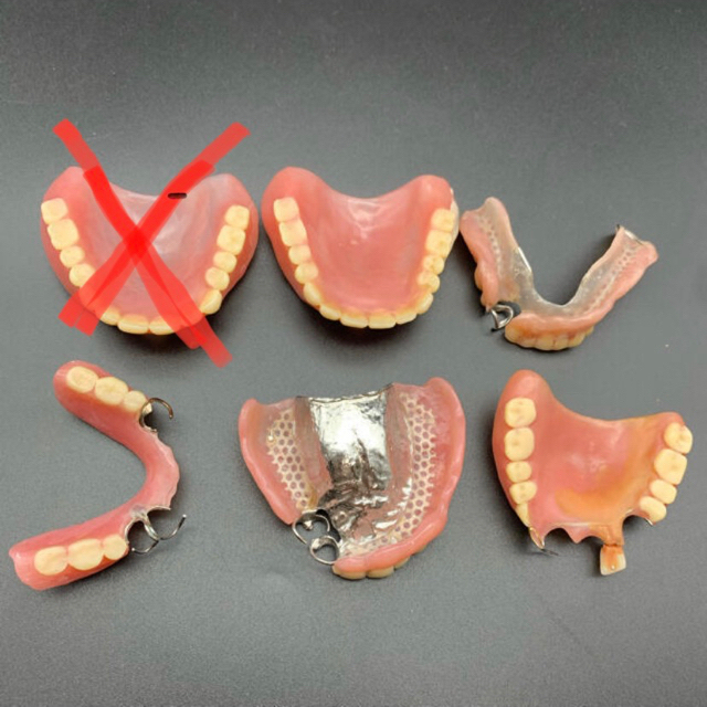 入れ歯　義歯　まとめて　金歯　貴金属　5個その他