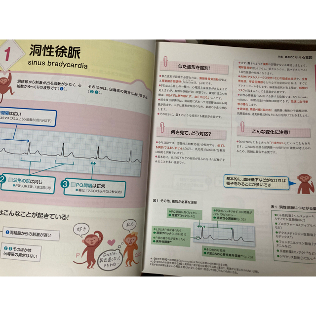 Expert Nurse 2016年 +モニター心電図の読み方 エンタメ/ホビーの雑誌(専門誌)の商品写真