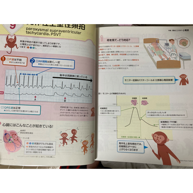 Expert Nurse 2016年 +モニター心電図の読み方 エンタメ/ホビーの雑誌(専門誌)の商品写真