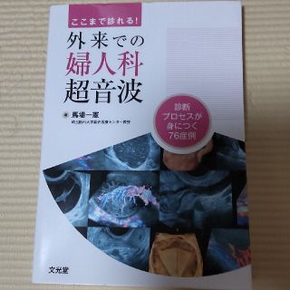 【ふにふに様】ここまで診れる！外来での婦人科超音波 診断プロセスが身につく(健康/医学)