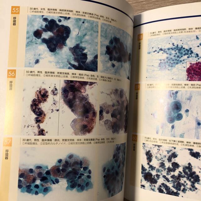 実用細胞診トレ－ニング これでわかる細胞の見方！ エンタメ/ホビーの本(健康/医学)の商品写真