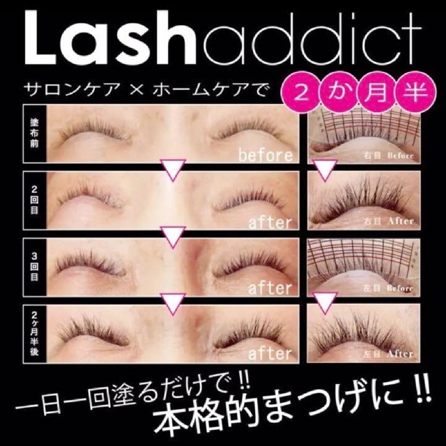 日本製 新品ラッシュアディクトLashaddict 睫毛美容液 まつ毛美容液