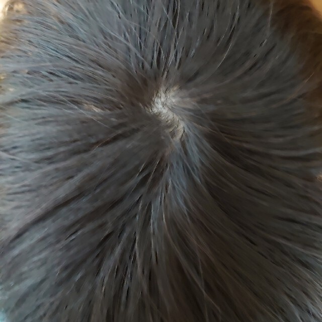 部分ウィッグ　レミー人毛100％　ヘアピース薄毛