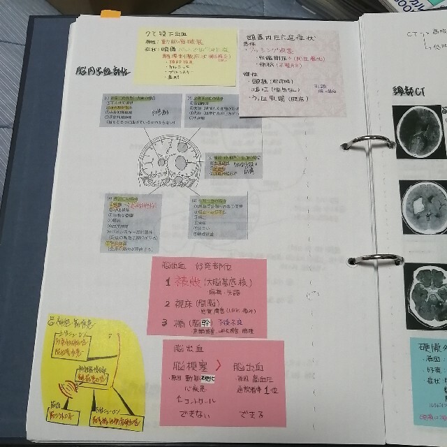 看護師　国家試験　国試　対策　付箋　ノート