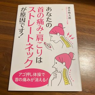 あなたの首の痛み・肩こりはストレ－トネックが原因です！(その他)