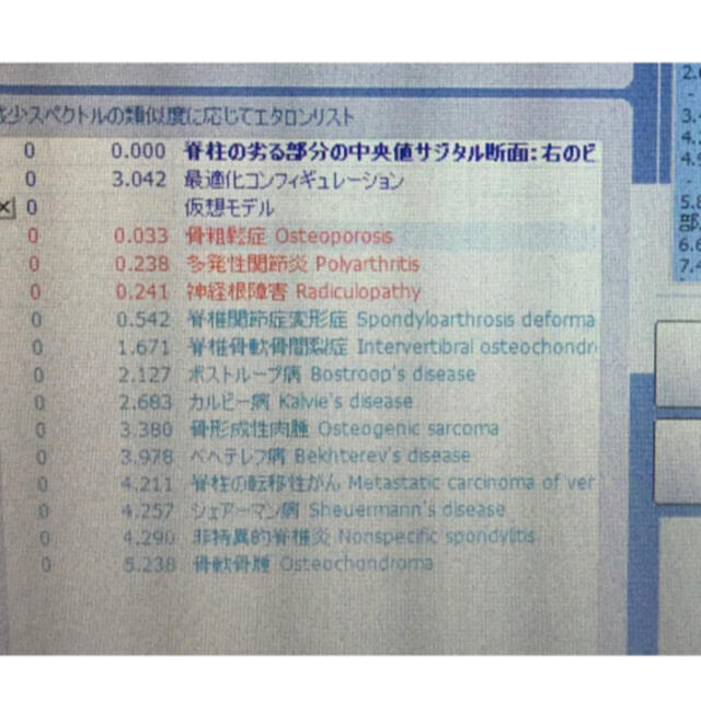 最新型！ニュースキャン、i scanタイプの健康測定機（コロナにも⁈）