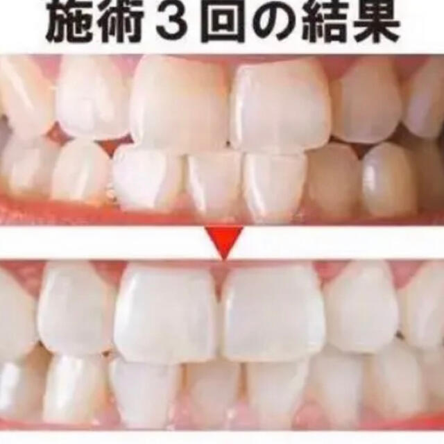 歯が真っ白ホームホワイトニング コスメ/美容のオーラルケア(口臭防止/エチケット用品)の商品写真