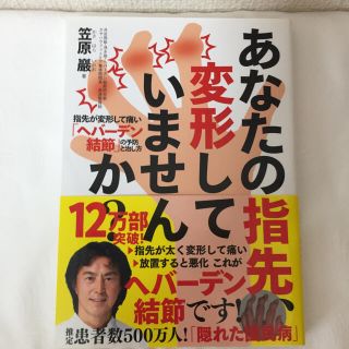 あなたの指先、変形していませんか？(健康/医学)