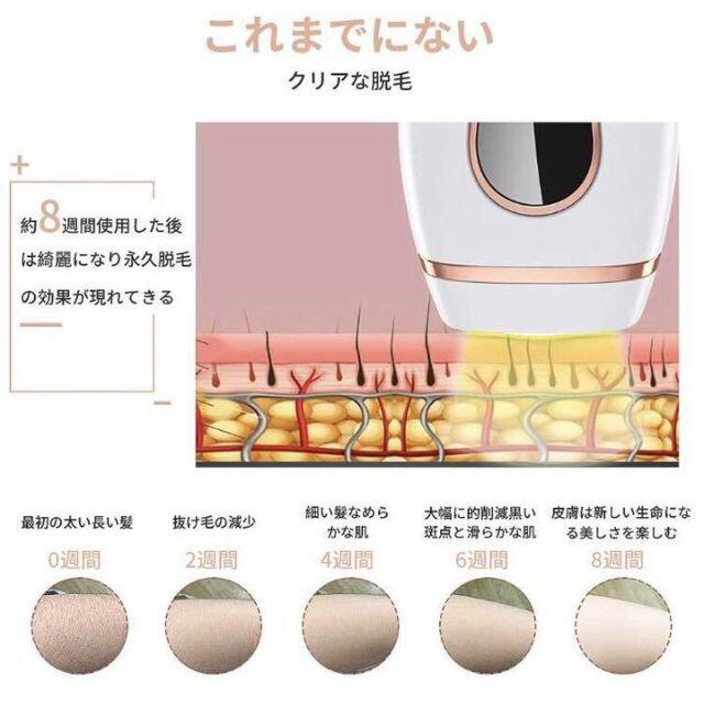 エステサロ ❤99万回照射❣プロのIPL光エステ技術で100%安全安心