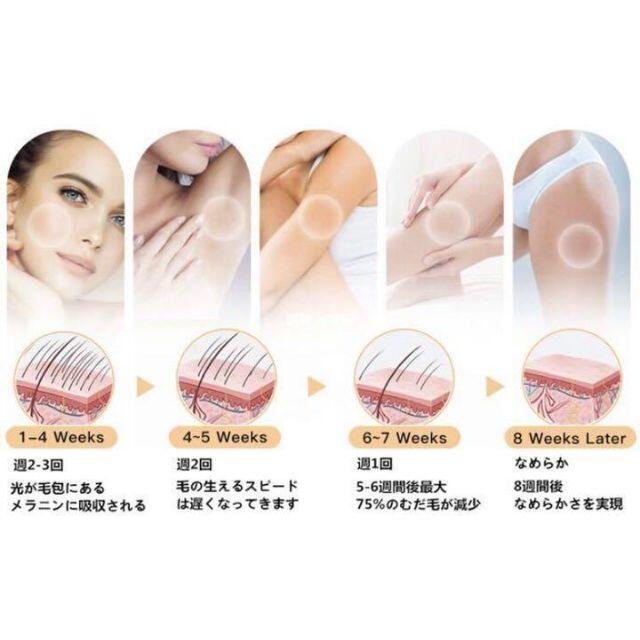 プロのIPL光エステ技術で100%安心安全♪❤99万回照射OK❣最新☆光脱毛