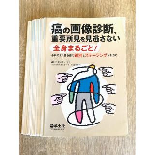 癌の画像診断、重要所見を見逃さない(健康/医学)