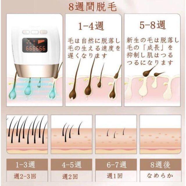 プロのIPL光エステ技術で100%安心安全♪❤99万回照射OK❣最新☆光脱毛