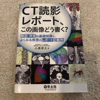 ＣＴ読影レポート、この画像どう書く？ 解剖・所見の基礎知識と、よくみる疾患のレポ(健康/医学)