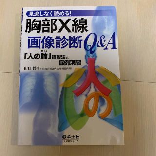 見逃しなく読める！胸部Ｘ線画像診断Ｑ＆Ａ 「人の肺」読影法と症例演習(健康/医学)