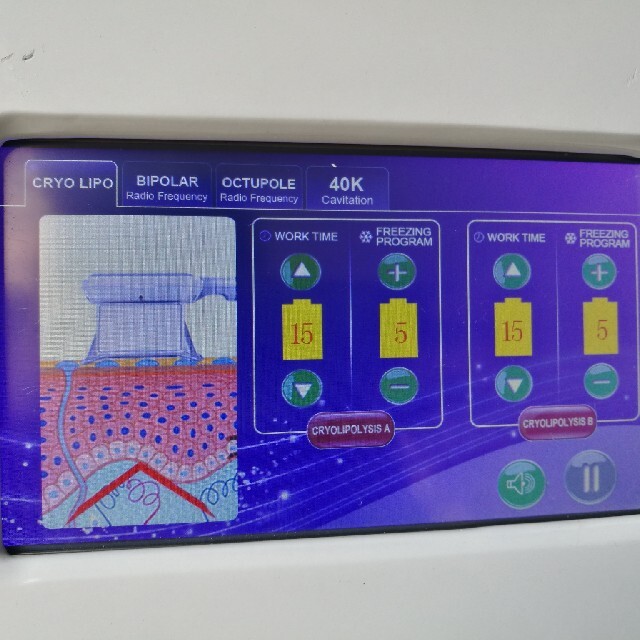 ラジオ波・脂肪冷却 エステ機器スマホ/家電/カメラ