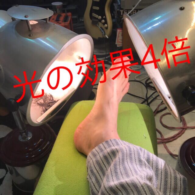 光線治療 ジョイントカーボン | www.hospitaldeyumbo.gov.co