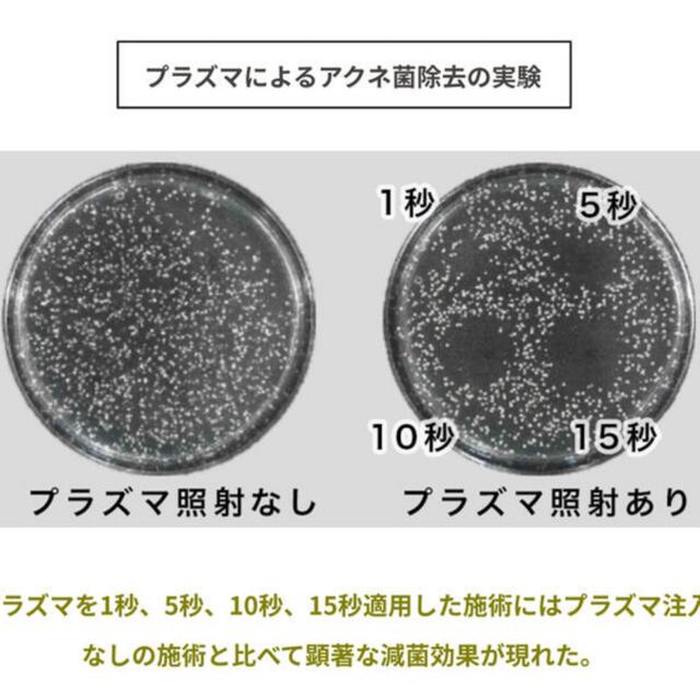 新品✨限定価格!プラズマシャワー✨🚿プラズマ+イオン導入 プラズマソニック✨ 新品✨限定価格!プラズマシャワー✨🚿プラズマ+イオン導入 プラズマソニック✨