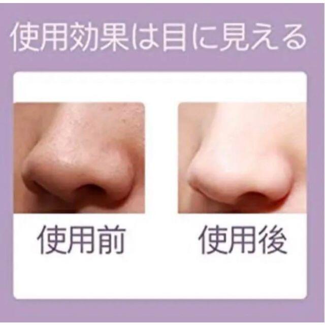 ❤毛穴の黒ずみや汚れを徹底吸引❣エステサロン帰りのツルスベ肌に