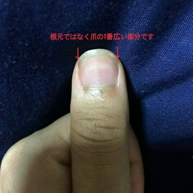 りぼん 量産型 地雷 ハート ブラック 黒 コスメ/美容のネイル(つけ爪/ネイルチップ)の商品写真