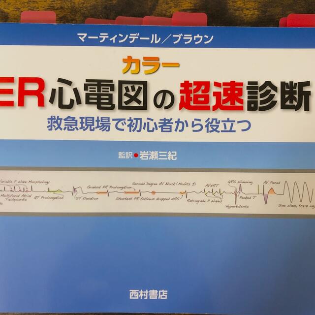 ER心電図の超速診断 by J's shop｜ラクマ 救急現場で初心者から役立つ