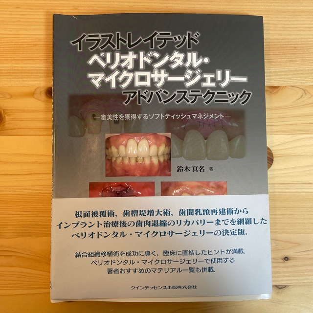 73%OFF!】 エビデンスに基づいた ペリオドンタルプラスティックサー