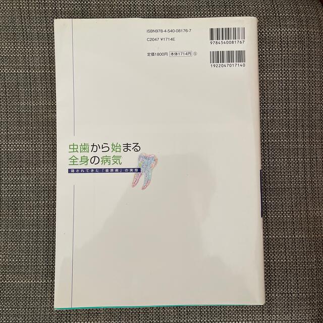虫歯から始まる全身の病気 隠されてきた「歯原病」の実態 エンタメ/ホビーの本(健康/医学)の商品写真