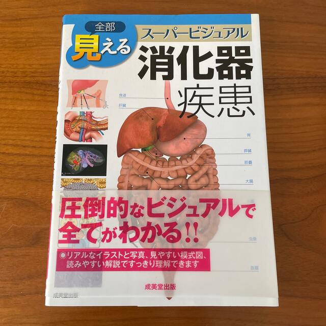 全部見える消化器疾患 ス－パ－ビジュアル エンタメ/ホビーの本(健康/医学)の商品写真