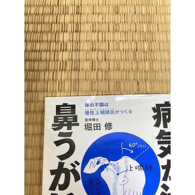 角川書店(カドカワショテン)の病気が治る鼻うがい健康法 体の不調は慢性上咽頭炎がつくる エンタメ/ホビーの本(健康/医学)の商品写真