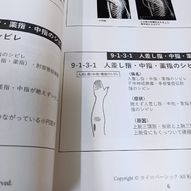 杉本錬堂 天城流医学大全集 症状別手・指の痛みシビレ編 杉本錬堂 天城流医学大全集 症状別手・指の痛みシビレ編