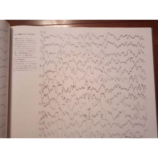 脳波アトラス 全5巻 文光堂 神経内科医向け エンタメ/ホビーの本(健康/医学)の商品写真
