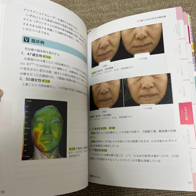 美容皮膚科ガイドブック 第２版 エンタメ/ホビーの本(健康/医学)の商品写真