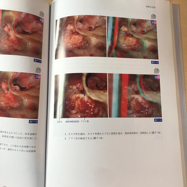 中耳・側頭骨解剖アトラス - 健康/医学 中耳・側頭骨解剖アトラス - 健康/医学