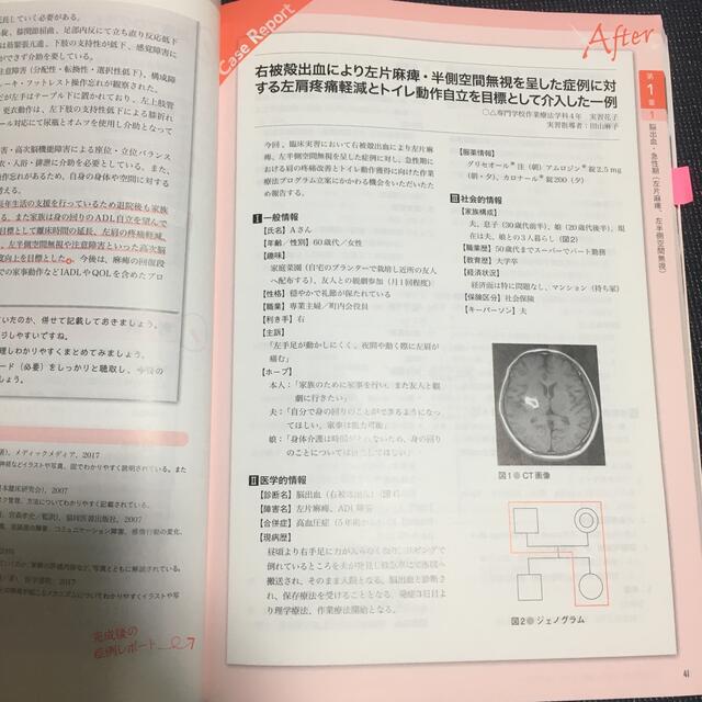 ＯＴ症例レポート赤ペン添削ビフォー＆アフター エンタメ/ホビーの本(健康/医学)の商品写真