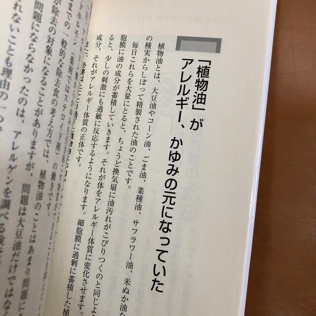 油を断てばアトピ－はここまで治る エンタメ/ホビーの本(健康/医学)の商品写真