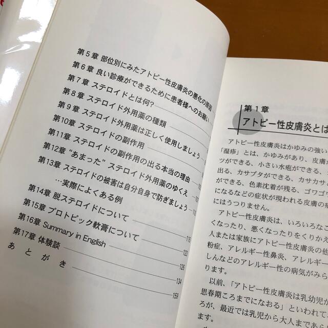 これなら安心　アトピー性皮膚炎 エンタメ/ホビーの本(健康/医学)の商品写真