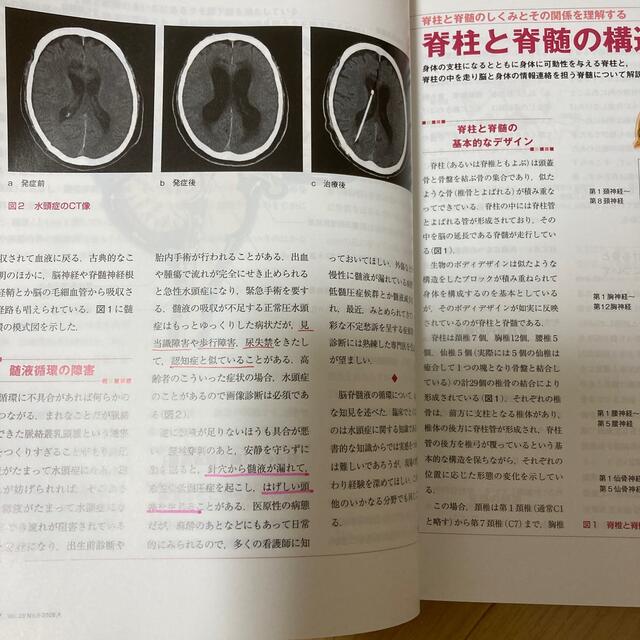 月刊ナーシング増刊 脳、神経、脊髄イラストレイテッド エンタメ/ホビーの雑誌(ニュース/総合)の商品写真
